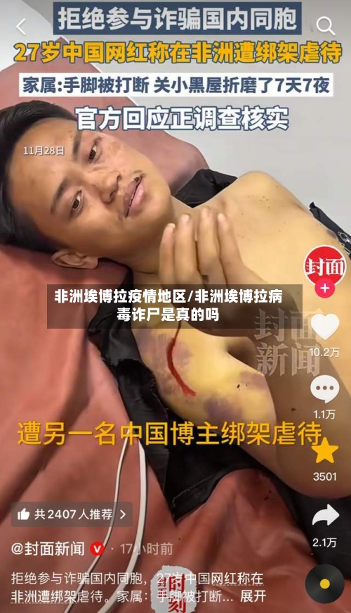 非洲埃博拉疫情地区/非洲埃博拉病毒诈尸是真的吗-第3张图片